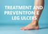 Kafada Oluşan Lekelerin Tedavisi ve Önlenmesi Treatment and Prevention of Leg Ulcers